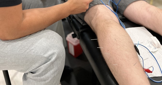 Dry Needling